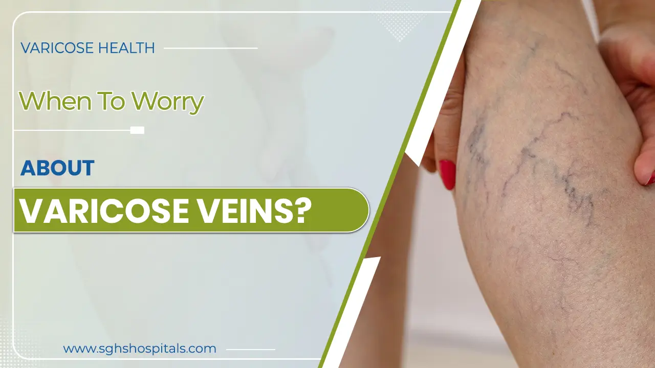 About Varicose Veins
