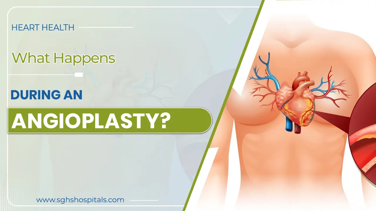 Best hospital for angioplasty