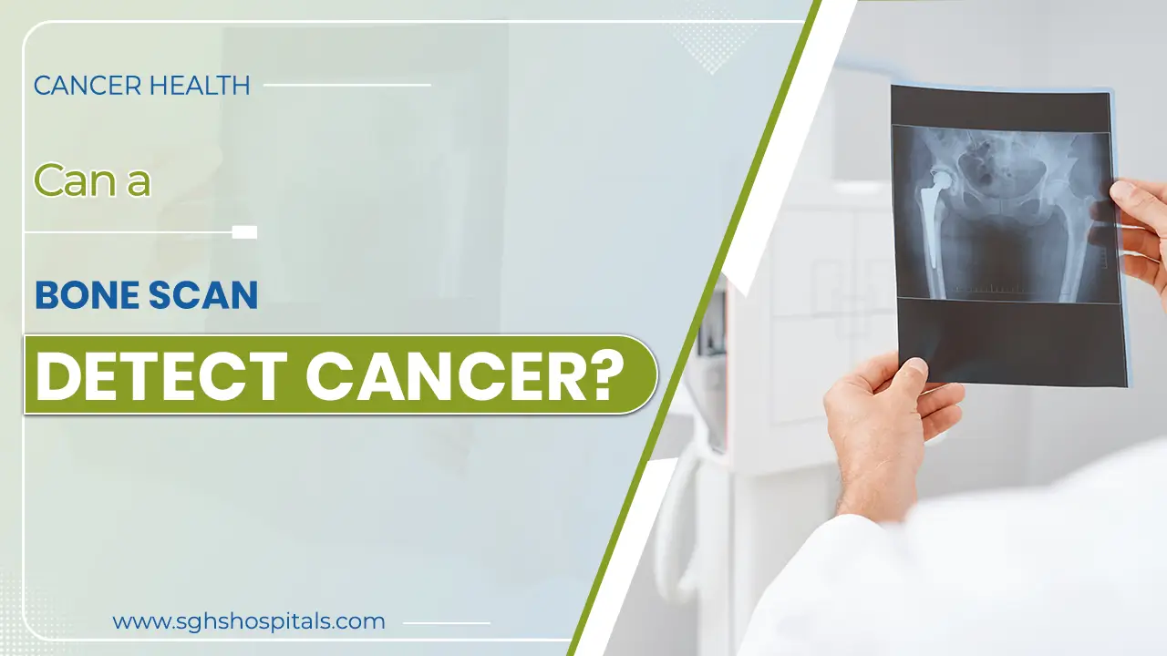 bone scan detect cancer