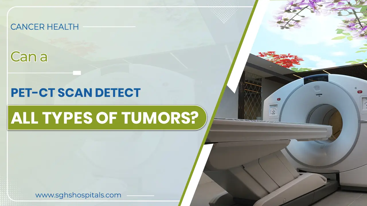 PET-CT Scan