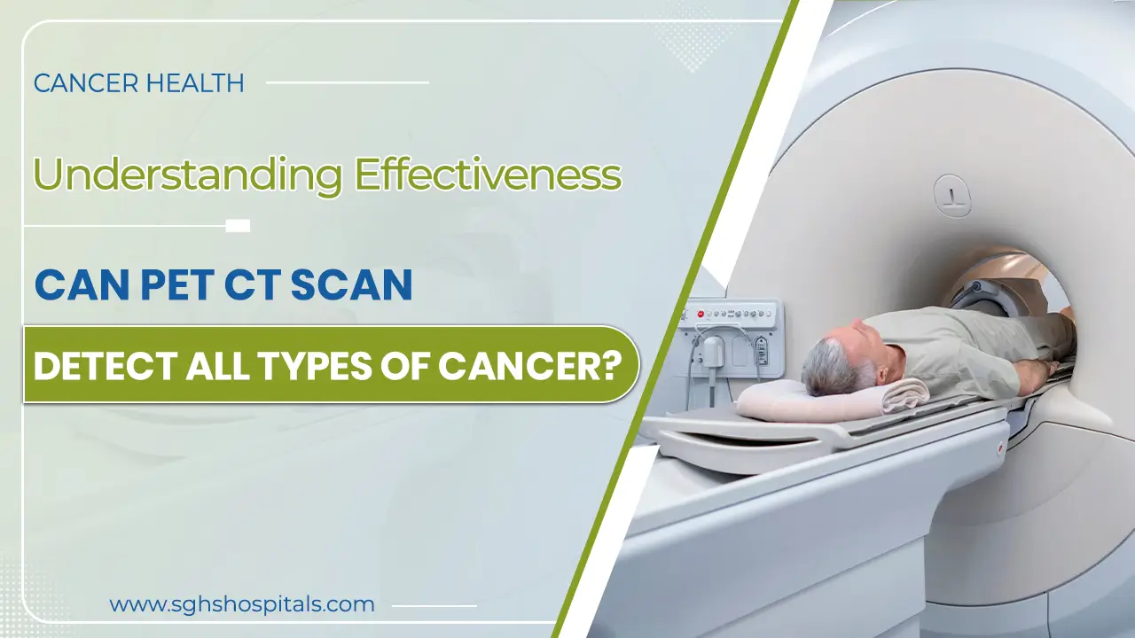 PET CT Scan in mohali