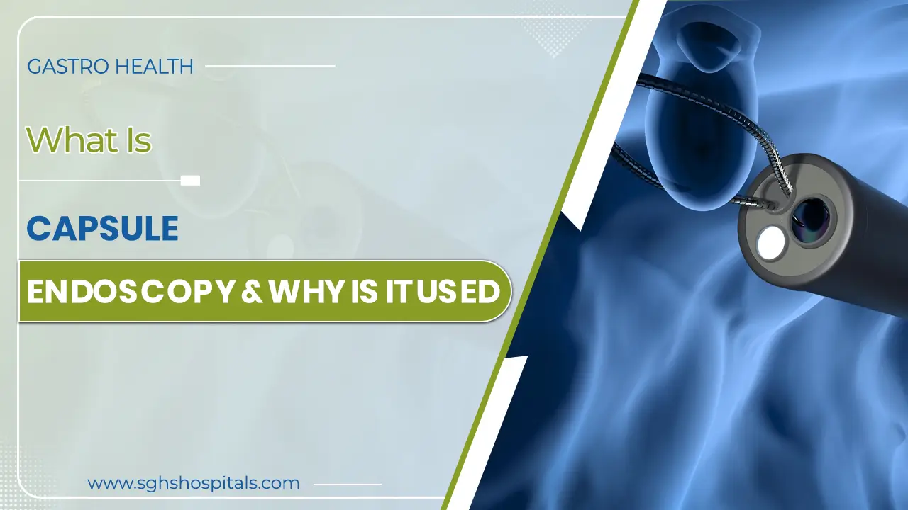 Capsule Endoscopy  treatment