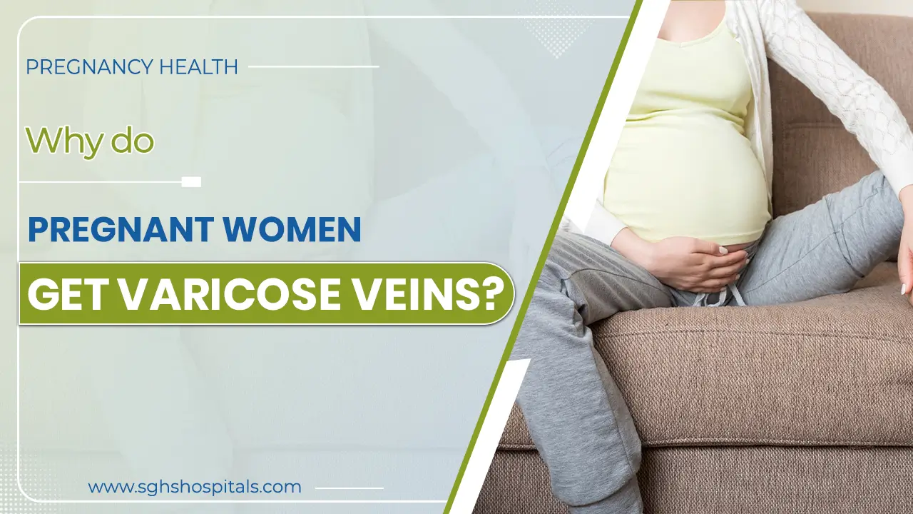 varicose veins treatment in Mohali